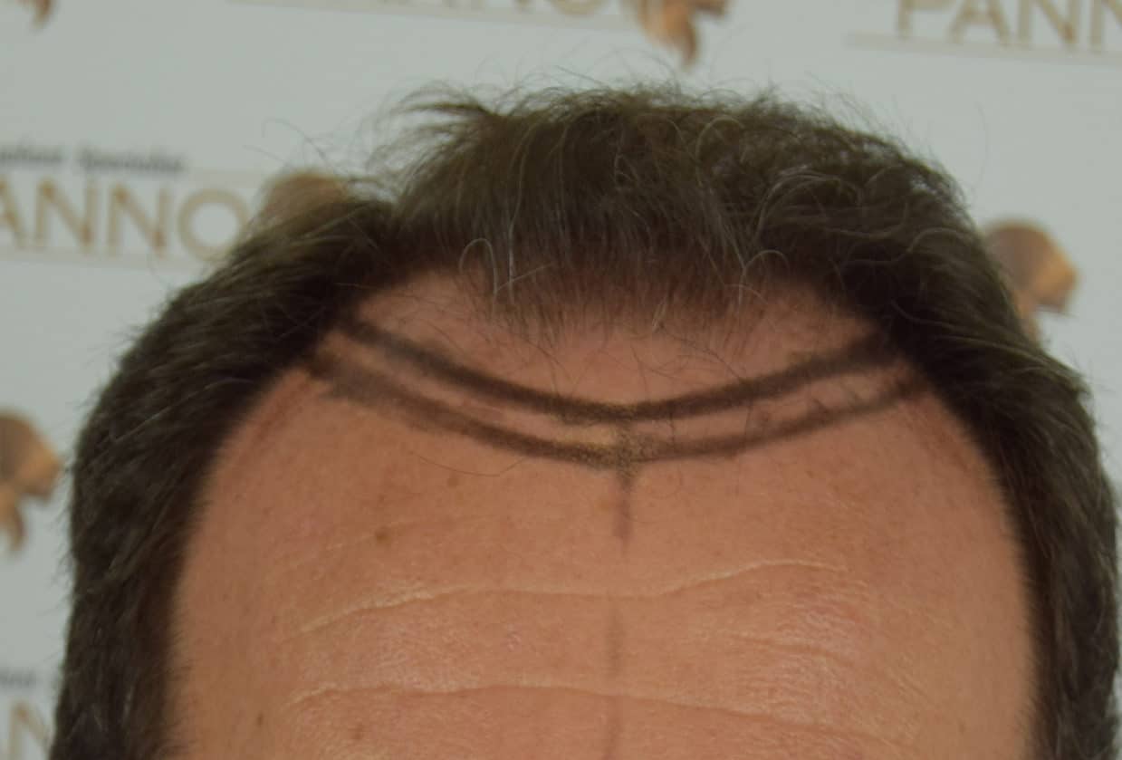 male before treatment 2