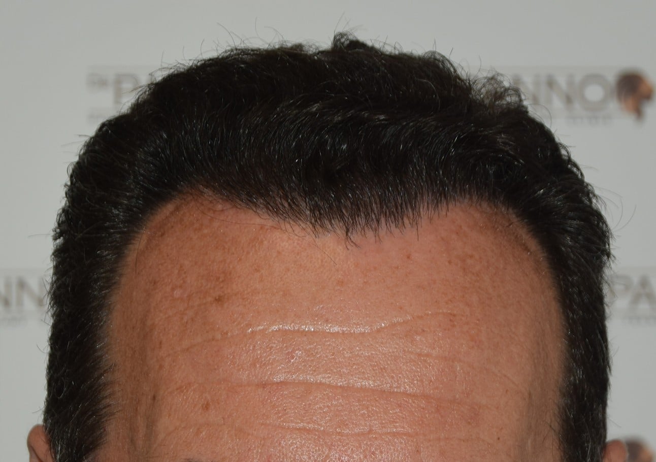 male after treatment 2
