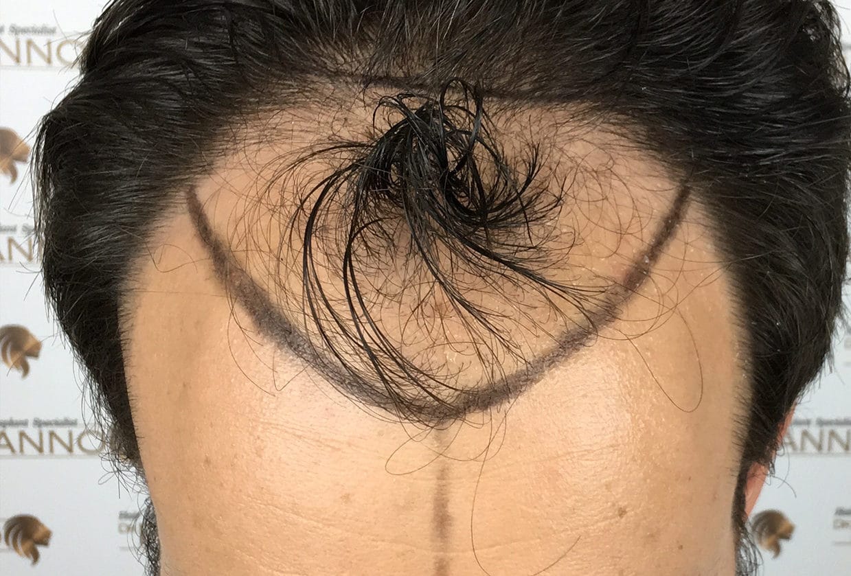 male before treatment 1