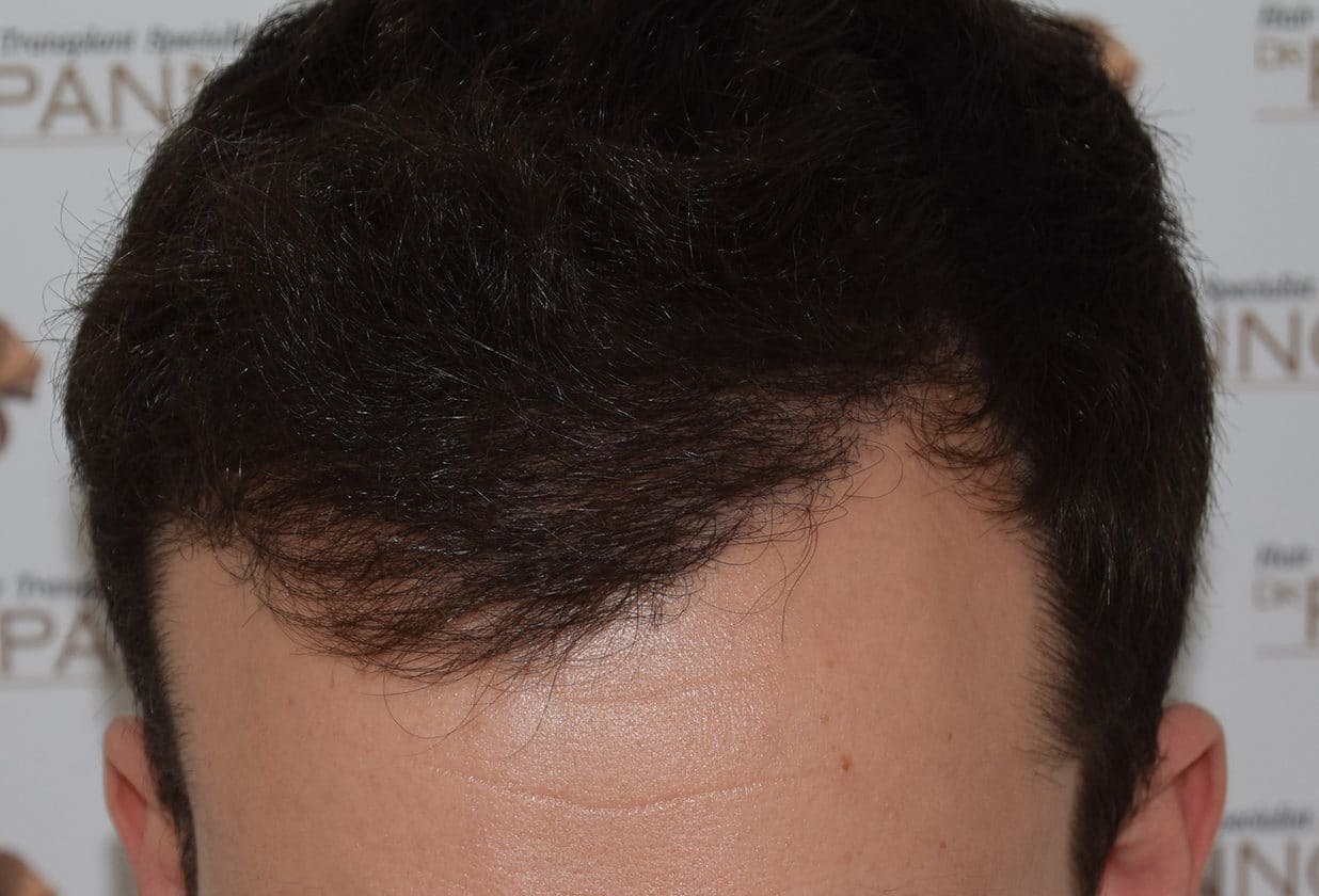 male after treatment 1