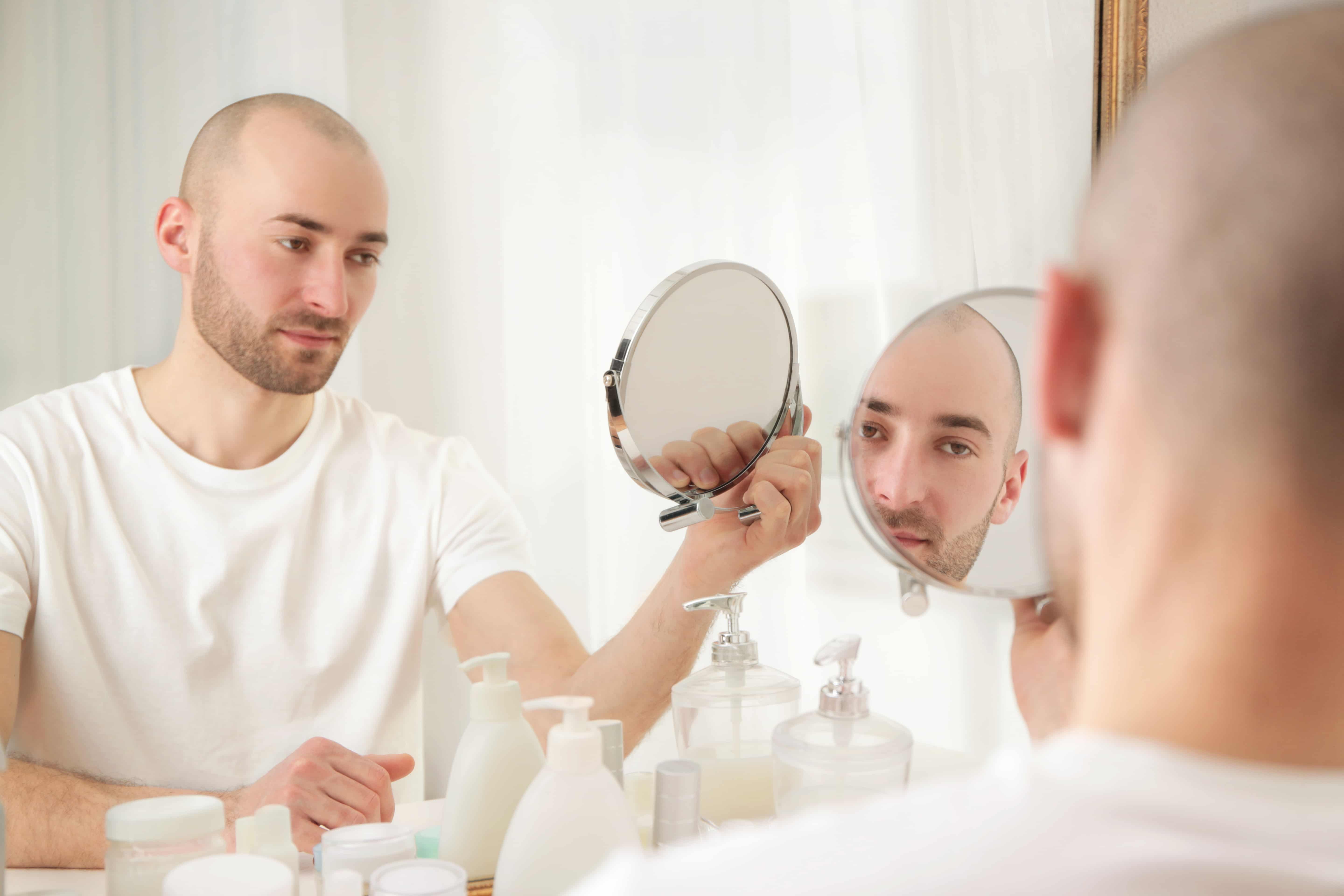 hair transplant