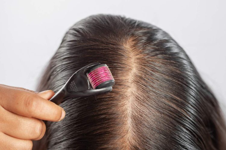 Ritlecitinib-primer-tratamiento-oral-para-alopecia-areata-en-adolescentes